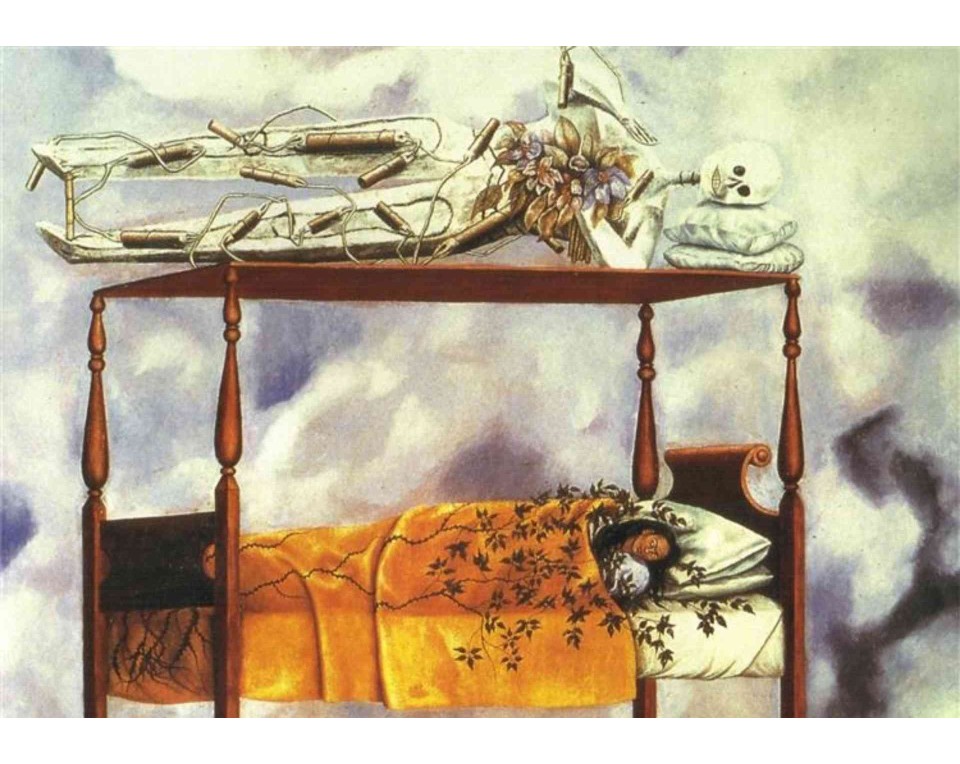 ΠΙΝΑΚΑΣ ΣΕ ΚΑΜΒΑ Frida Kahlo - Το Όνειρο